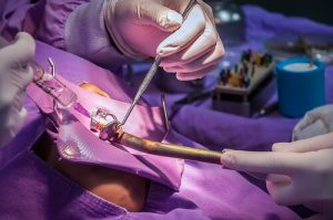 dental surgeon near me